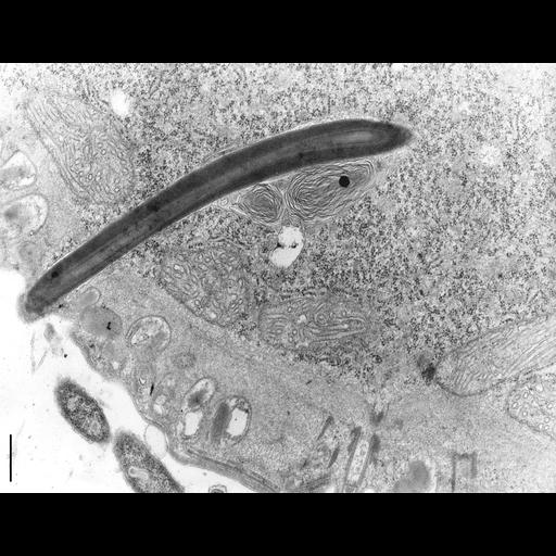 eukaryotic cell