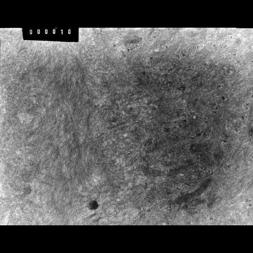 barrier epithelial cell