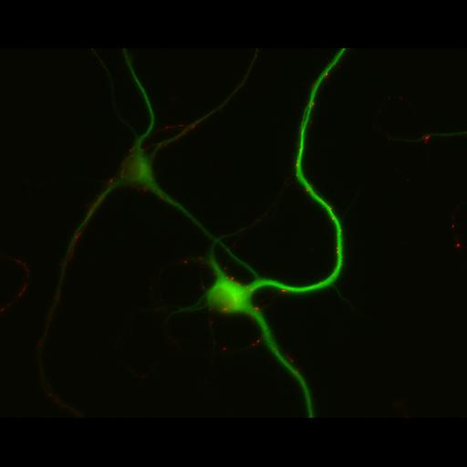 multipolar neuron
