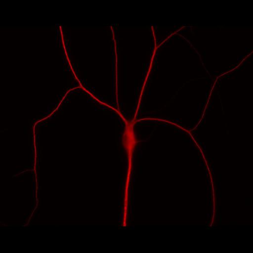 multipolar neuron