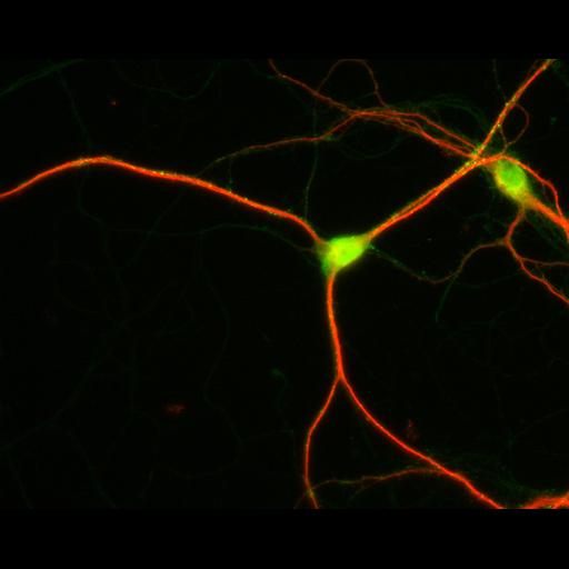 multipolar neuron