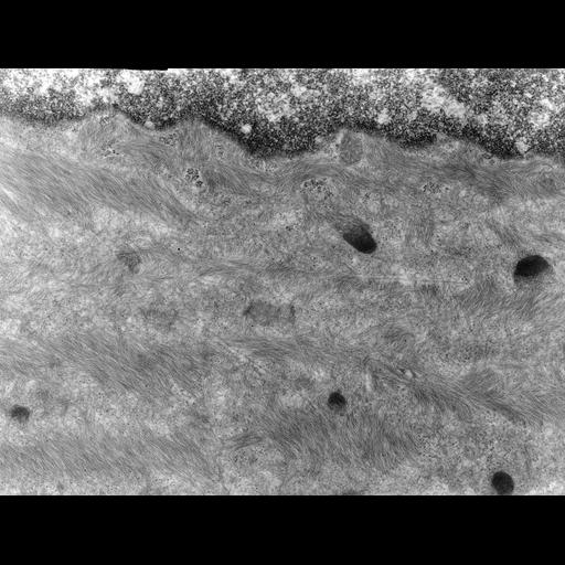 barrier epithelial cell