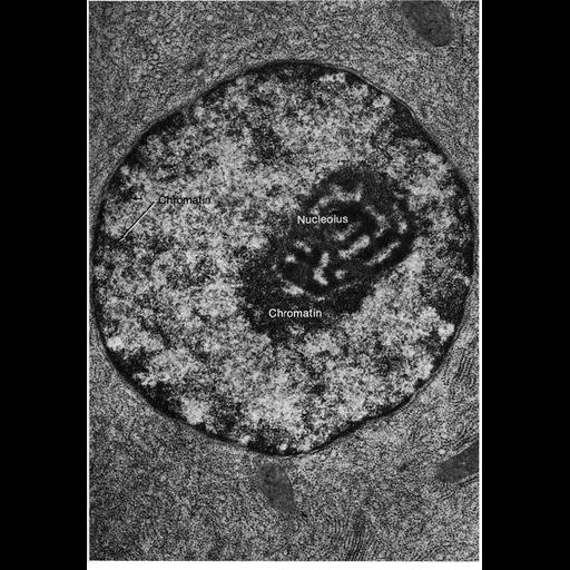 pancreatic acinar cell