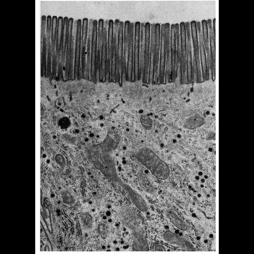 ciliated epithelial cell
