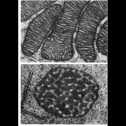 mitochondrion