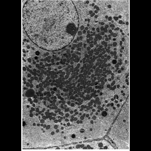 Leydig cell