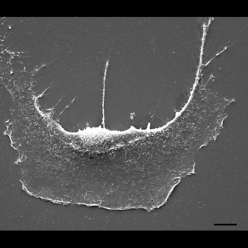 bone-marrow-derived fibroblast