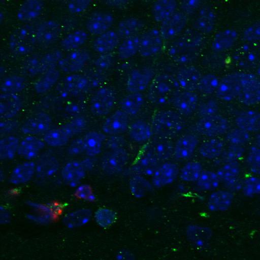 neuronal stem cell