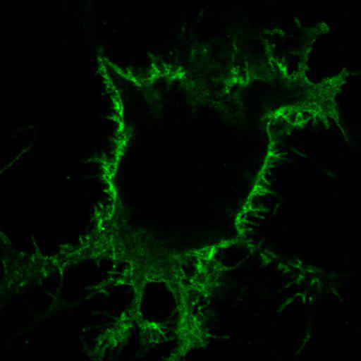 endoplasmic reticulum