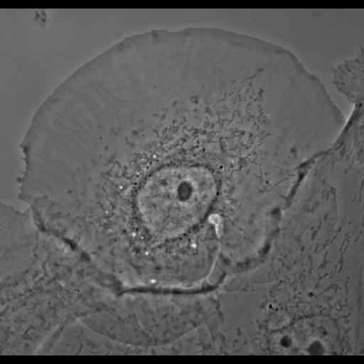 epithelial cell