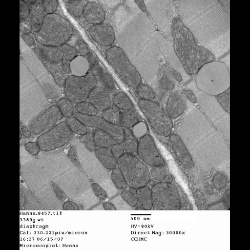 skeletal muscle cell