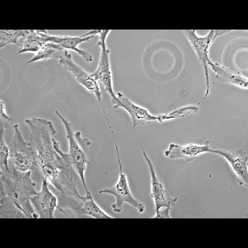 retinal pigment epithelium