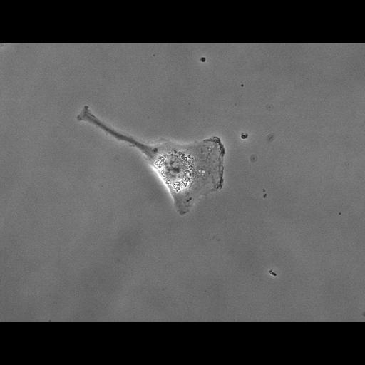 retinal pigment epithelium