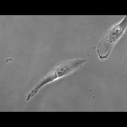 retinal pigment epithelium