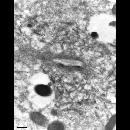 eukaryotic cell