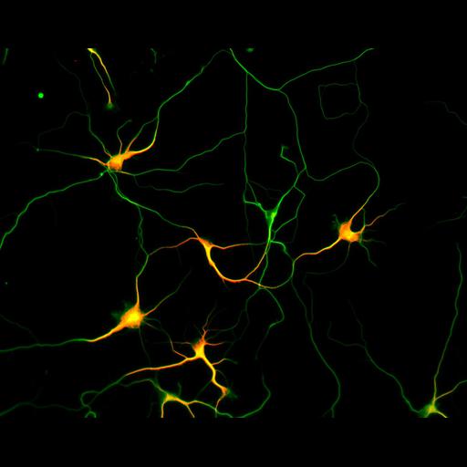 multipolar neuron