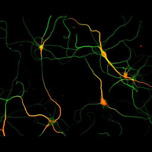 multipolar neuron