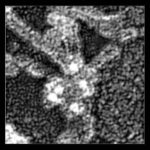 actin cytoskeleton