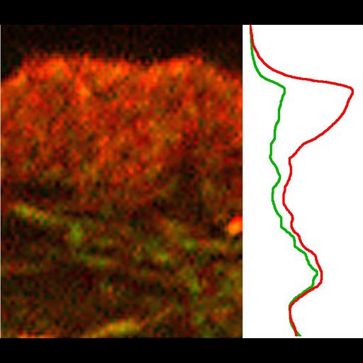 fibroblast