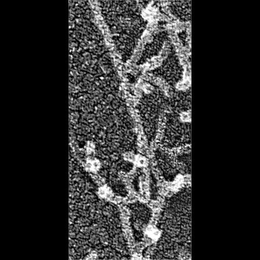 actin cytoskeleton