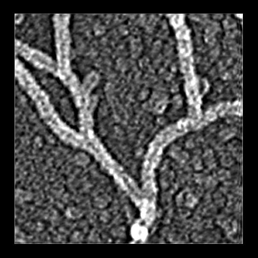 actin cytoskeleton