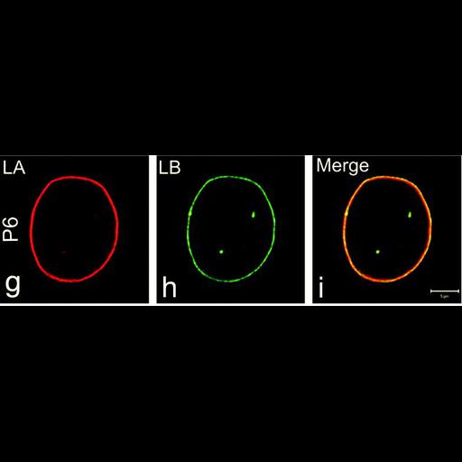 fibroblast