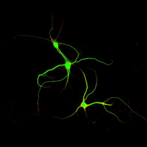 multipolar neuron