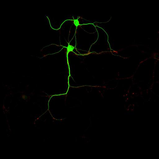 multipolar neuron