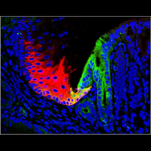 squamous basal cells