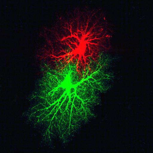 astrocyte