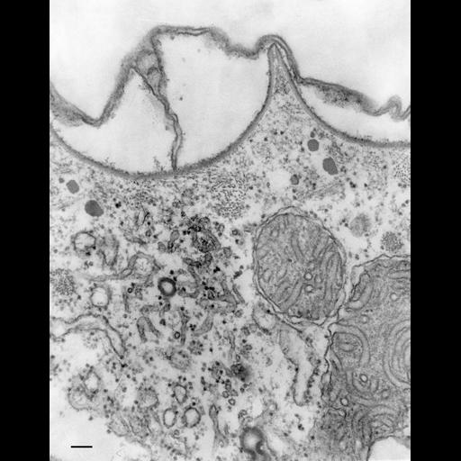 eukaryotic cell