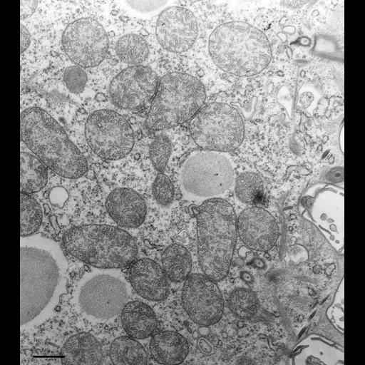 eukaryotic cell