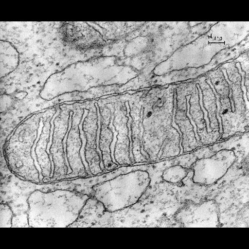 pancreatic cell