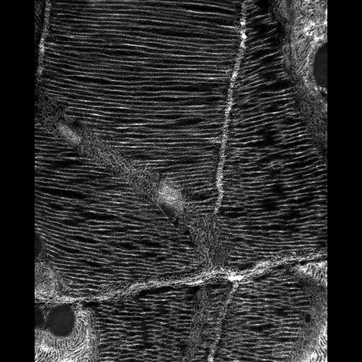 flight muscle cell