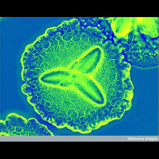 Gram-negative bacteria