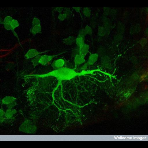 reticulospinal neuron