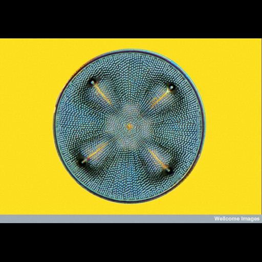 diatom