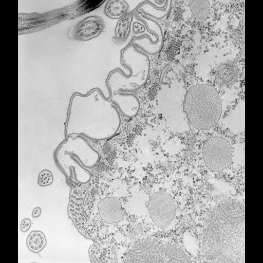 eukaryotic cell