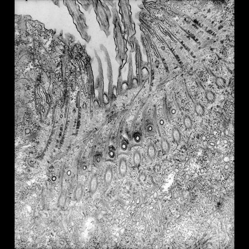 eukaryotic cell