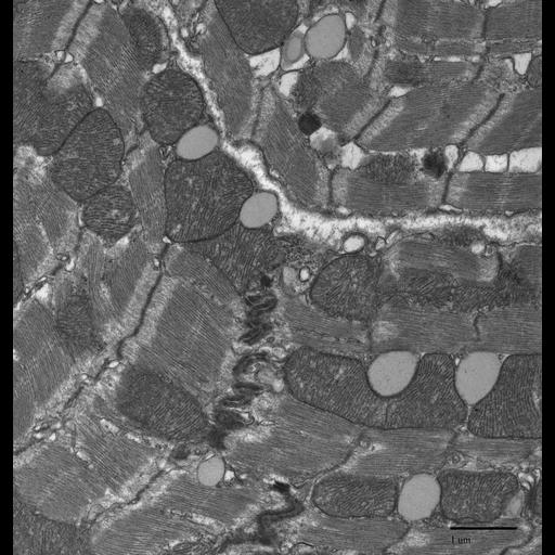 cardiac muscle cell