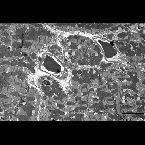 cardiac muscle cell