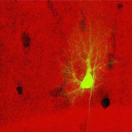 astrocyte