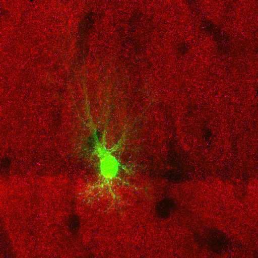 astrocyte