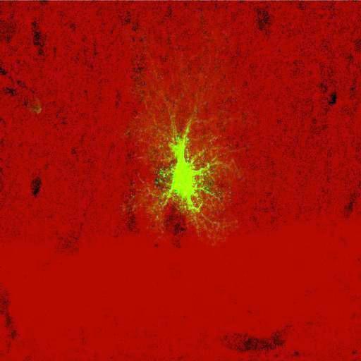 astrocyte