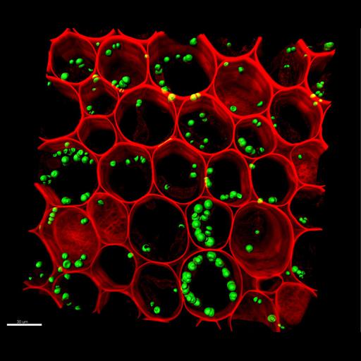 cell wall