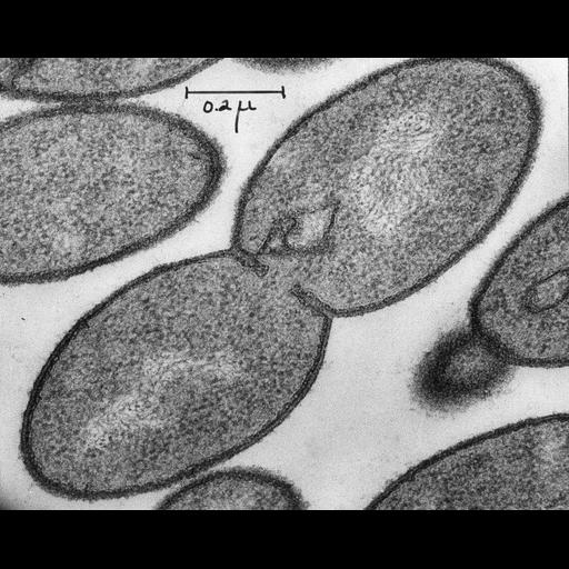 ribosome