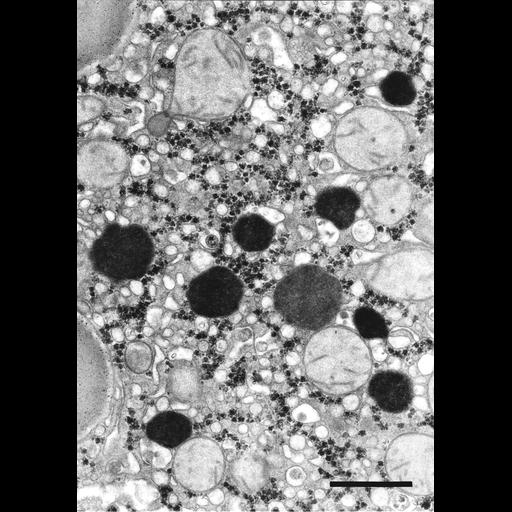 parenchymal cell