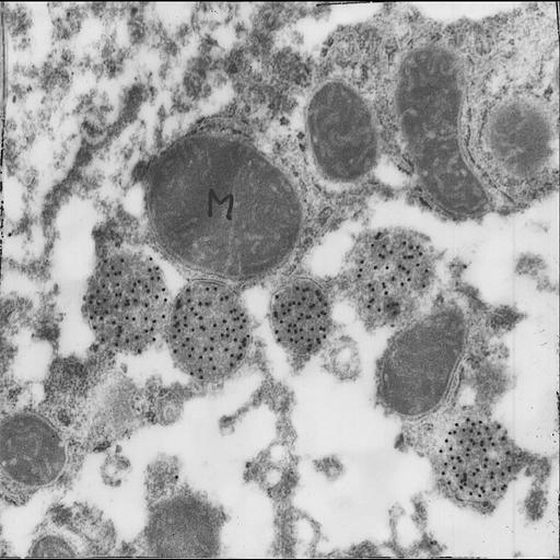 parenchymal cell