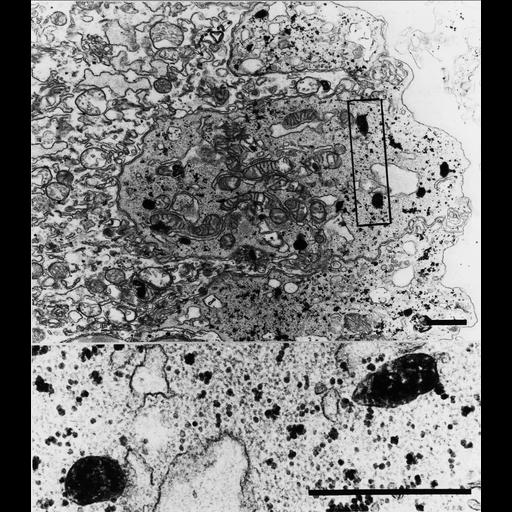 mononuclear cytotrophoblast cell