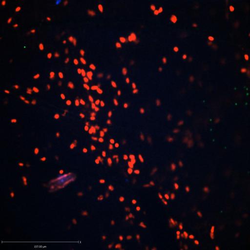 neutrophil